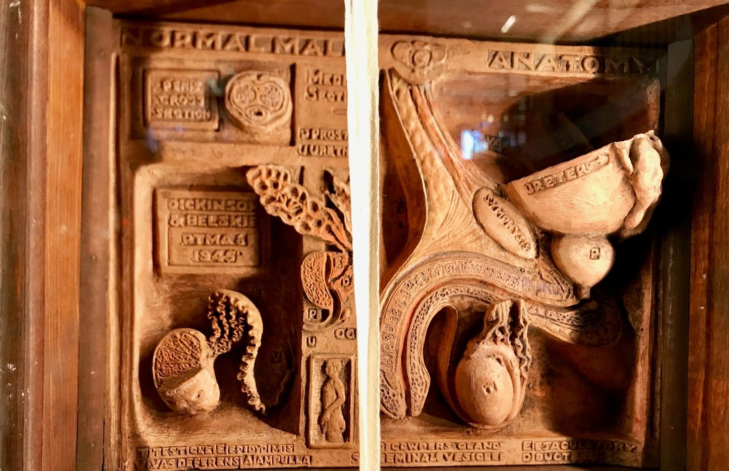 Dickinson-Belskie Collection, Warren Anatomical Museum, Boston (by Luca Ambrosio) (2).jpg